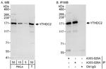 YTHDC2 Antibody in Western Blot (WB)