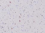 IDH1 (mutant R132H) Antibody in Immunohistochemistry (Paraffin) (IHC (P))