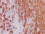 S-100 Antibody in Immunohistochemistry (Paraffin) (IHC (P))