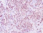 WT-1 Antibody in Immunohistochemistry (Paraffin) (IHC (P))