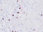 HSV1 Antibody in Immunohistochemistry (Paraffin) (IHC (P))