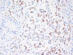 Thrombomodulin / CD141 Antibody in Immunohistochemistry (Paraffin) (IHC (P))