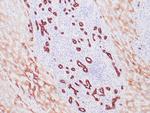 Cytokeratin 8/18 Antibody in Immunohistochemistry (Paraffin) (IHC (P))