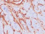 Collagen IV Antibody in Immunohistochemistry (Paraffin) (IHC (P))