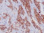 Her-2/neu Antibody in Immunohistochemistry (Paraffin) (IHC (P))