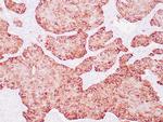 Uroplakin Antibody in Immunohistochemistry (Paraffin) (IHC (P))