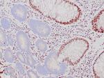 MSH2 Antibody in Immunohistochemistry (Paraffin) (IHC (P))