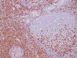 CD2 Antibody in Immunohistochemistry (Paraffin) (IHC (P))