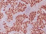 OCT-4 Antibody in Immunohistochemistry (Paraffin) (IHC (P))