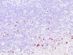 IgG4 Antibody in Immunohistochemistry (Paraffin) (IHC (P))