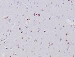 Olig2 Antibody in Immunohistochemistry (Paraffin) (IHC (P))