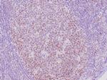 Rb Antibody in Immunohistochemistry (Paraffin) (IHC (P))