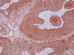 Cytokeratin 14 Antibody in Immunohistochemistry (Paraffin) (IHC (P))