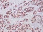 ER Antibody in Immunohistochemistry (Paraffin) (IHC (P))