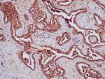 Napsin A Antibody in Immunohistochemistry (Paraffin) (IHC (P))