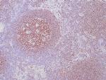 OCT-2 Antibody in Immunohistochemistry (Paraffin) (IHC (P))