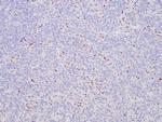 ATRX Antibody in Immunohistochemistry (Paraffin) (IHC (P))