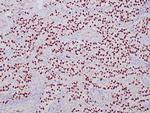 SALL4 Antibody in Immunohistochemistry (Paraffin) (IHC (P))