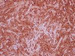 STAT6 Antibody in Immunohistochemistry (Paraffin) (IHC (P))