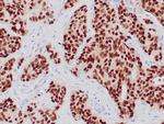 PR Antibody in Immunohistochemistry (Paraffin) (IHC (P))