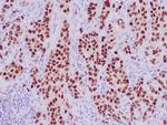 GATA3 Antibody in Immunohistochemistry (Paraffin) (IHC (P))