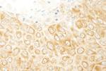 ZAK Antibody in Immunohistochemistry (IHC)