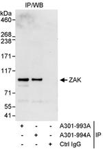 ZAK Antibody in Immunoprecipitation (IP)