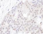 ZAP3 Antibody in Immunohistochemistry (IHC)