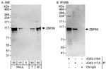 ZBP89 Antibody in Western Blot (WB)