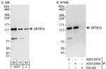 ZBTB10 Antibody in Western Blot (WB)