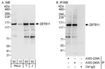 ZBTB11 Antibody in Western Blot (WB)