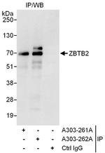 ZBTB2 Antibody in Immunoprecipitation (IP)