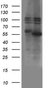 ZBTB32 Antibody in Western Blot (WB)