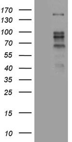 ZBTB4 Antibody in Western Blot (WB)