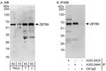 ZBTB9 Antibody in Western Blot (WB)