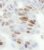 ZC3H11A Antibody in Immunohistochemistry (IHC)