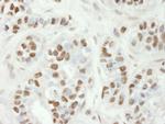 ZC3H11A Antibody in Immunohistochemistry (IHC)