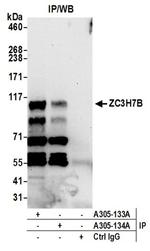 ZC3H7B Antibody in Western Blot (WB)