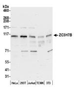 ZC3H7B Antibody in Western Blot (WB)