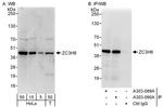 ZC3H8 Antibody in Western Blot (WB)