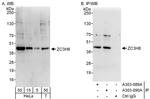 ZC3H8 Antibody in Western Blot (WB)