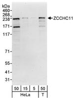 ZCCHC11 Antibody in Western Blot (WB)