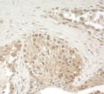 ZCCHC11 Antibody in Immunohistochemistry (IHC)