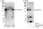 ZCCHC14 Antibody in Western Blot (WB)