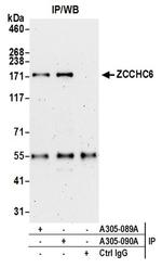 ZCCHC6 Antibody in Immunoprecipitation (IP)