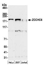 ZCCHC6 Antibody in Western Blot (WB)