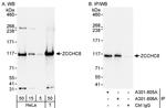 ZCCHC8 Antibody in Western Blot (WB)