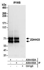 ZDHHC5 Antibody in Western Blot (WB)