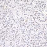 ZEB1 Antibody in Immunohistochemistry (IHC)