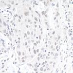 ZEB1 Antibody in Immunohistochemistry (IHC)